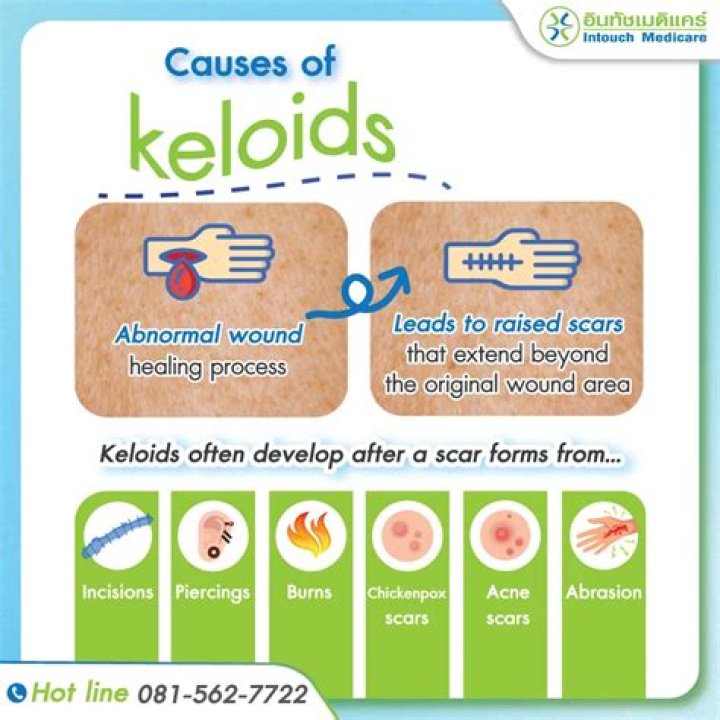 Are keloids cancerous?