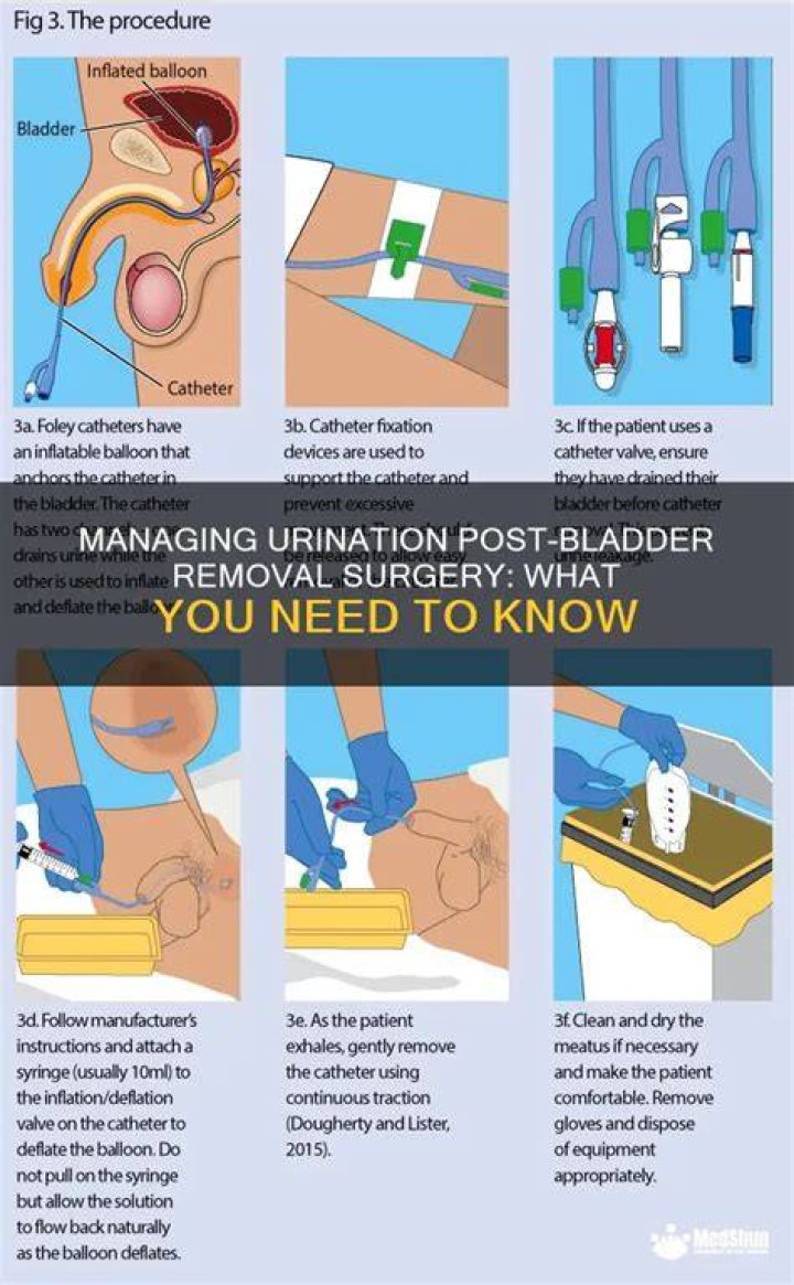 Can you urinate during surgery?