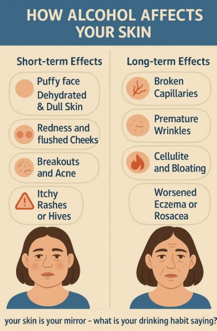 Does alcohol affect eczema?