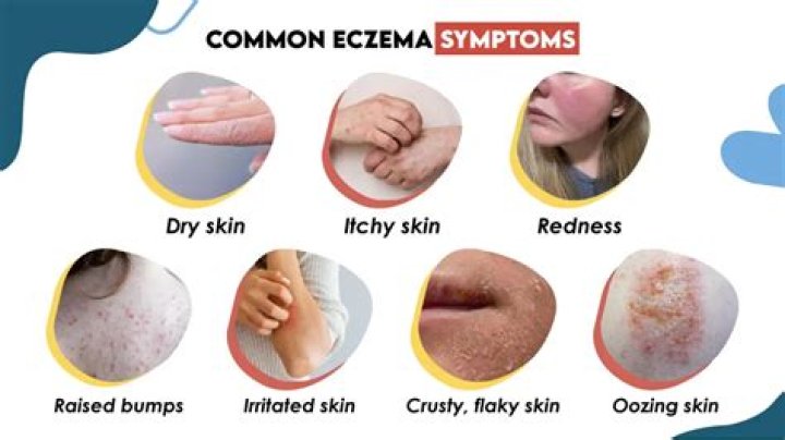 Is eczema skin acidic or alkaline?