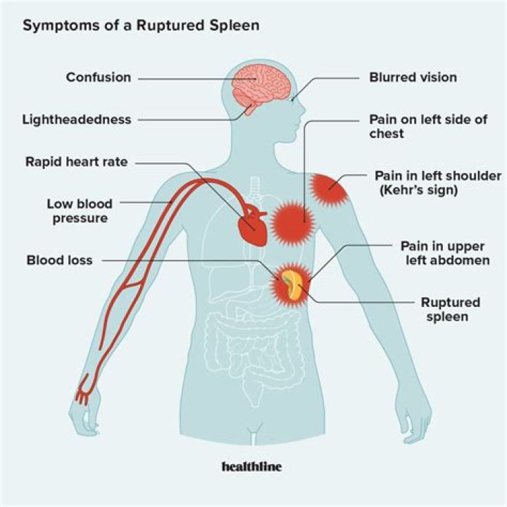 What are the symptoms of stomach paralysis?