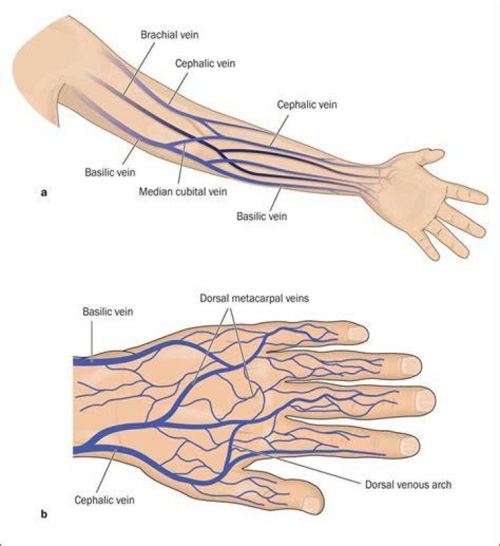 Why is the vein in my arm throbbing?
